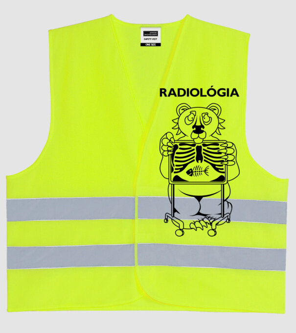  minta neonsárga pólón